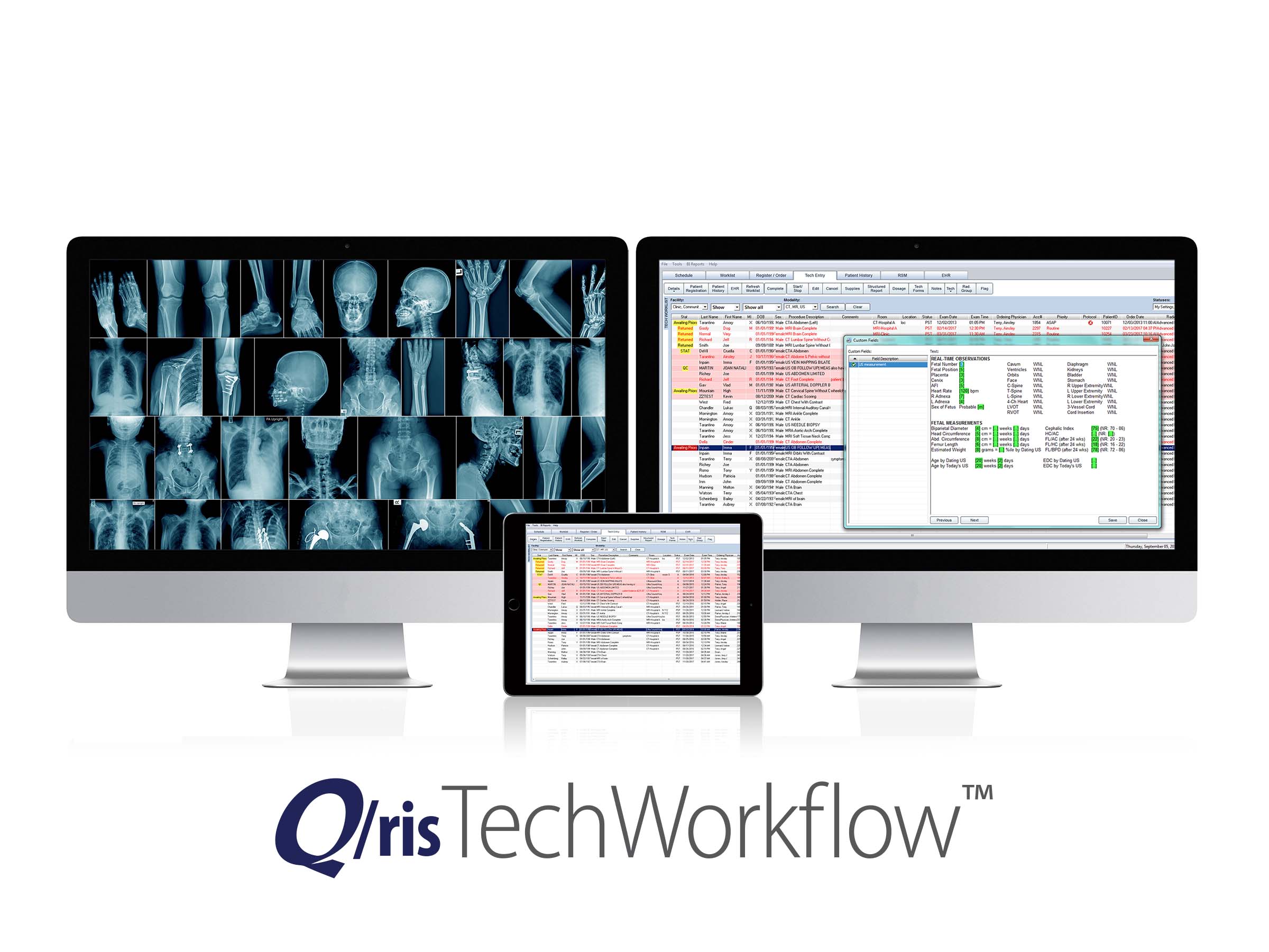 Q/ris Tech Workflow