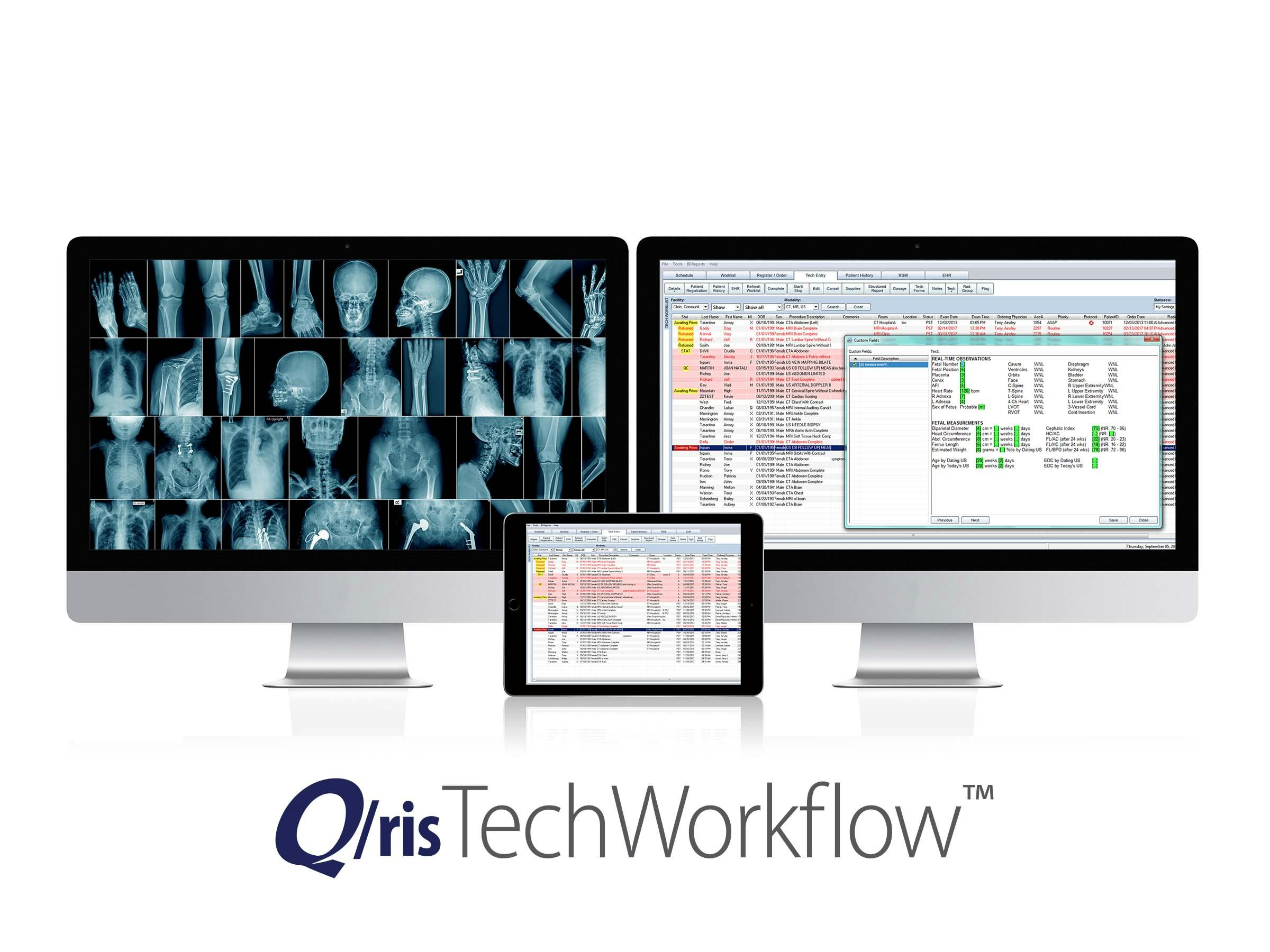 Q/ris 3000 Workflow Software - Q/ris Tech Workflow