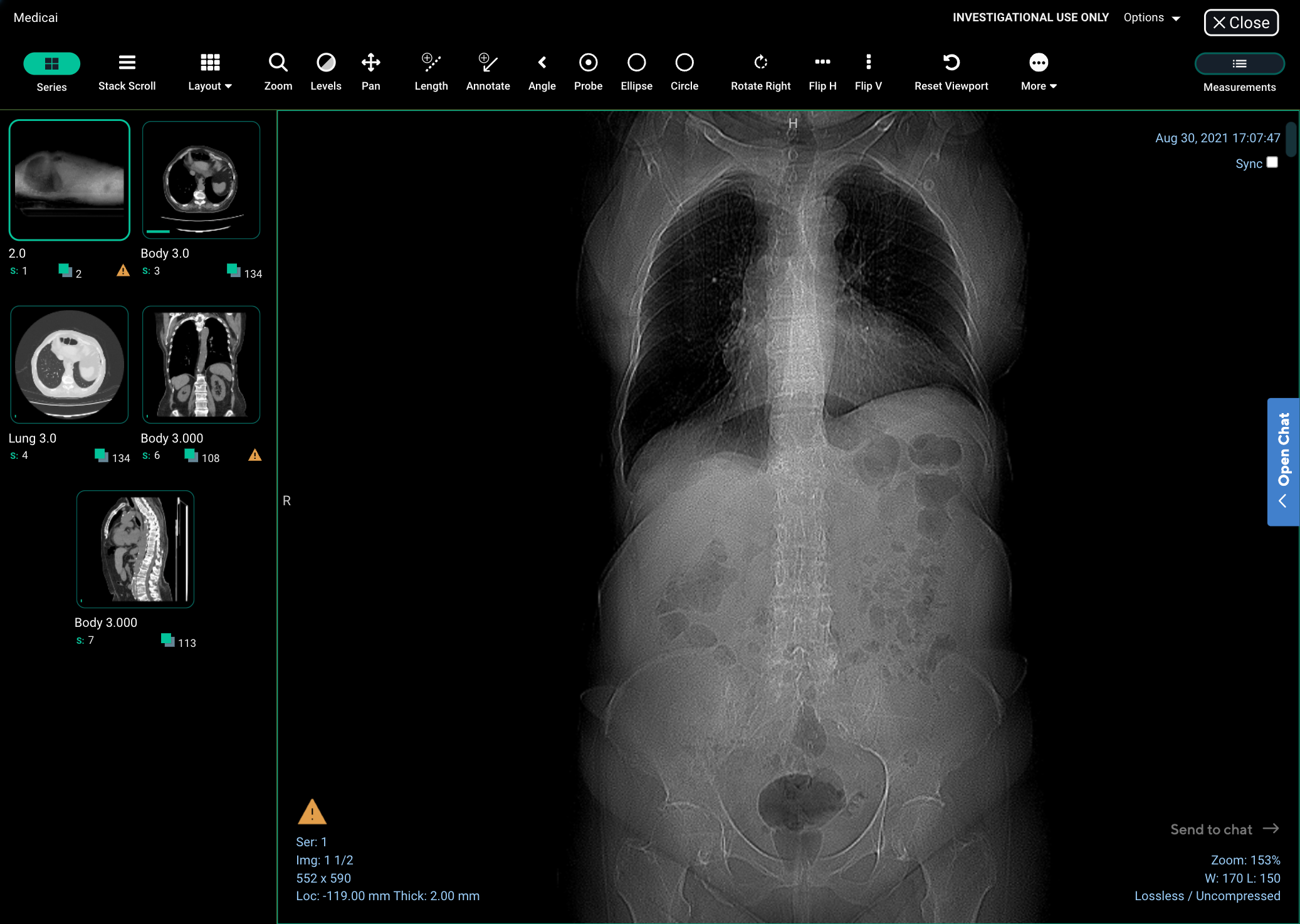 Viewer for medical imaging. Could be uploaded automatically or manually