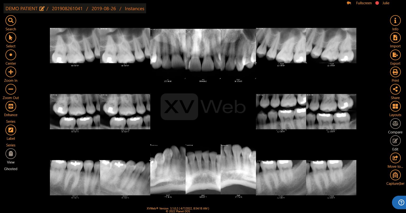 Apteryx XVWeb screenshot: Apteryx - Full Mouth Series
