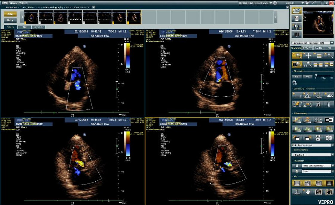 EMR viewer, ultrasound