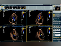 VEPRO PACS EMR Software - 4 - Vorschau