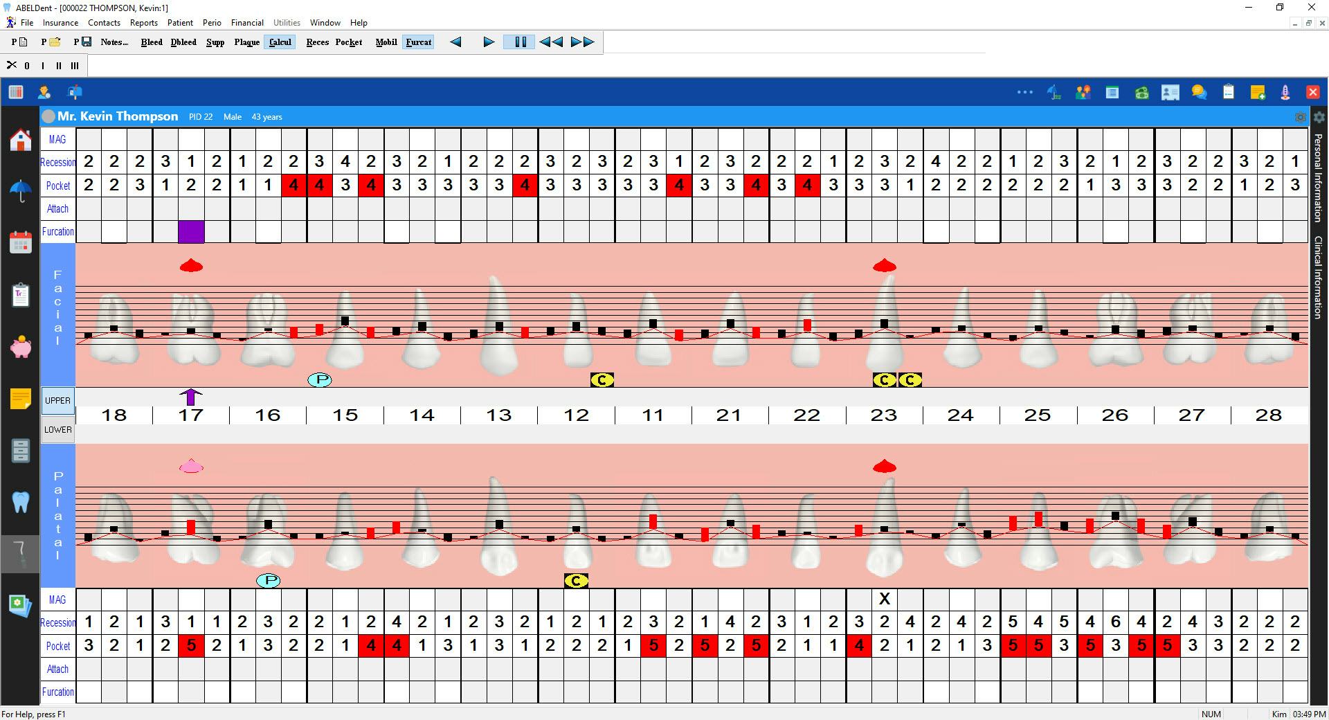 ABELDent Software - ABELDent calculations