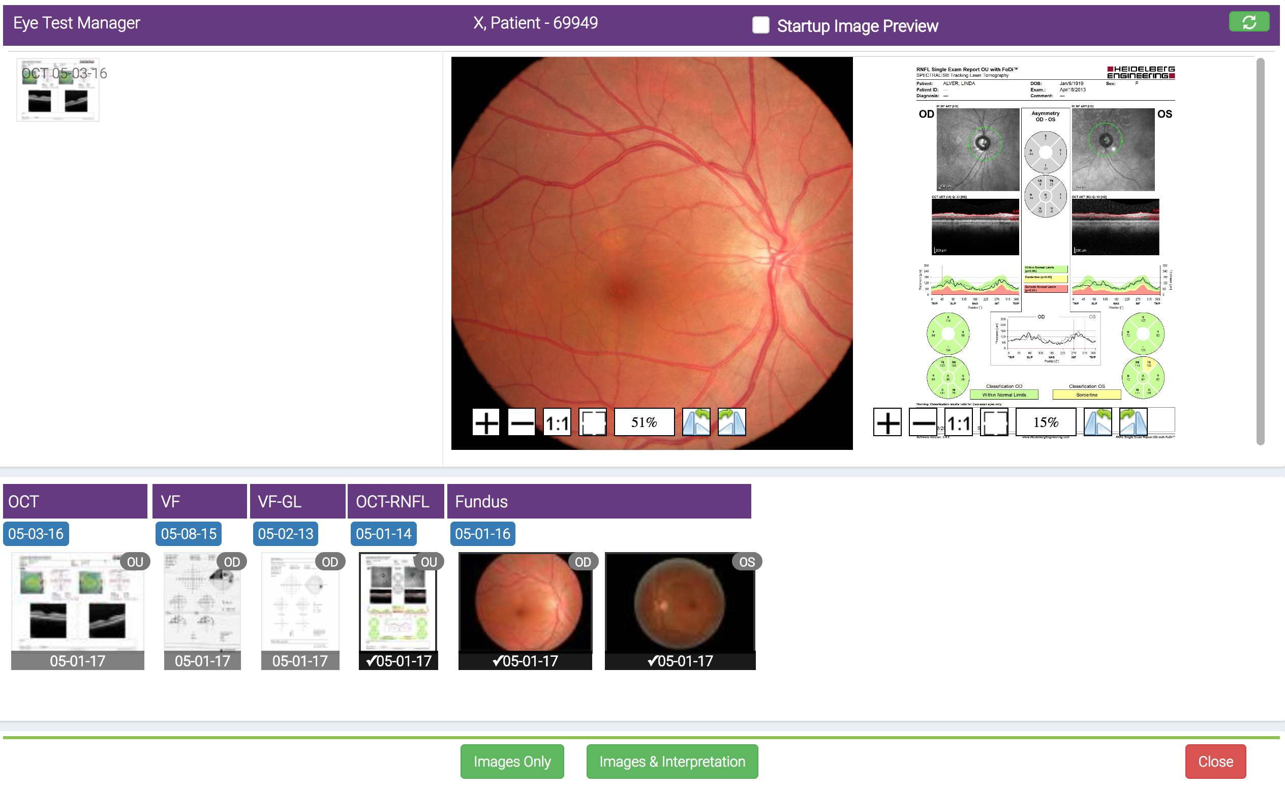 Eye test manager