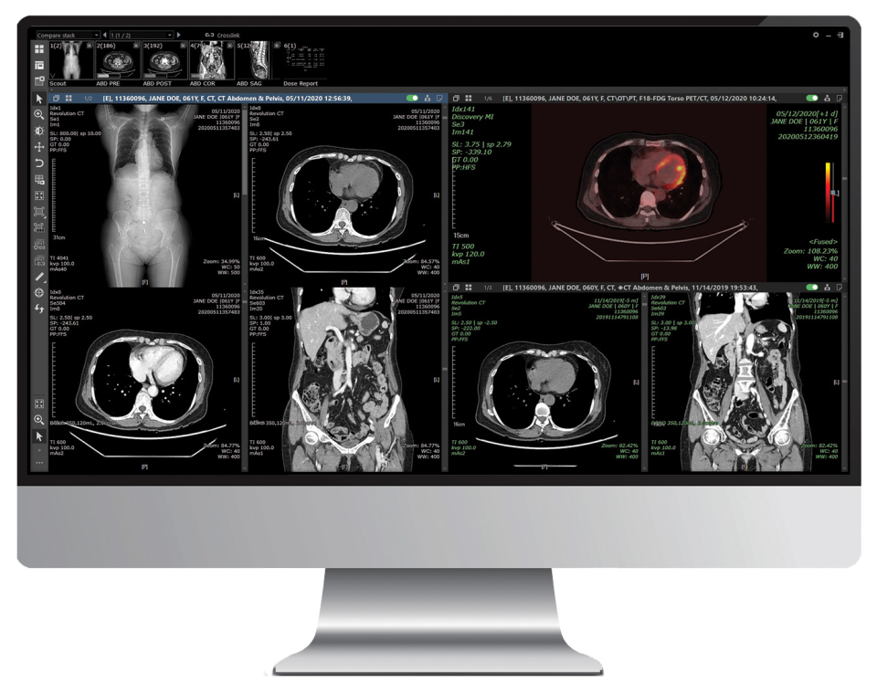 INFINITT PACS Software - 4