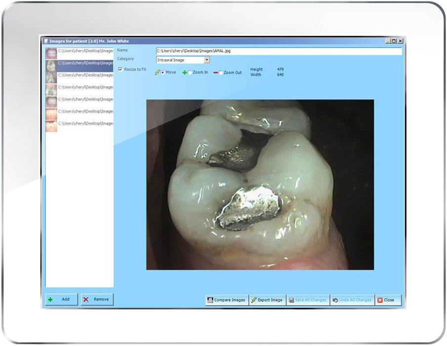 Maxident Software - Save high quality digital images per tooth