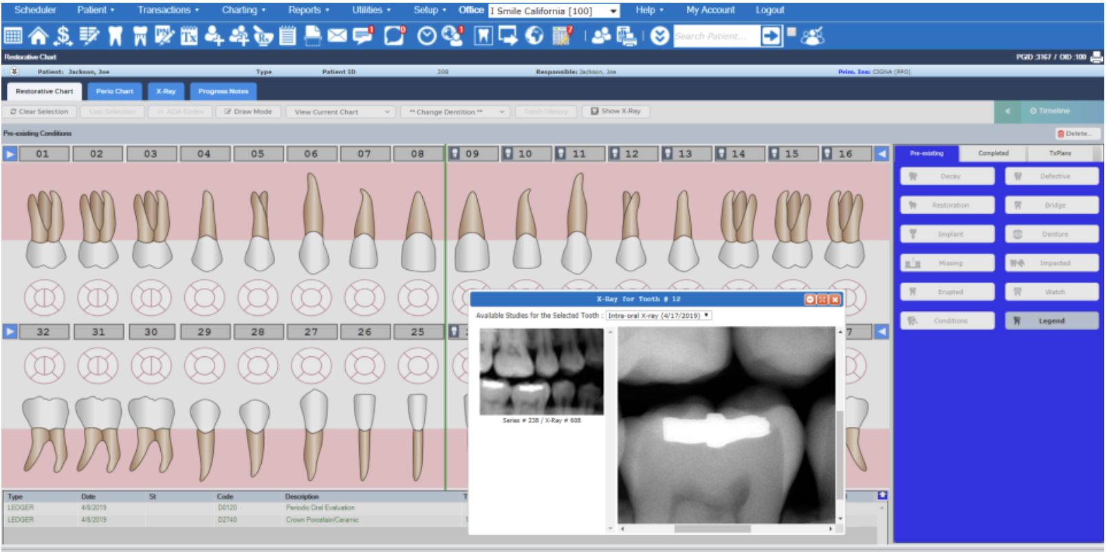 Denticon Patient Chart with Integrated Imaging