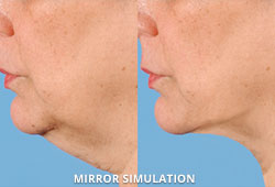 Mirror Software - 1