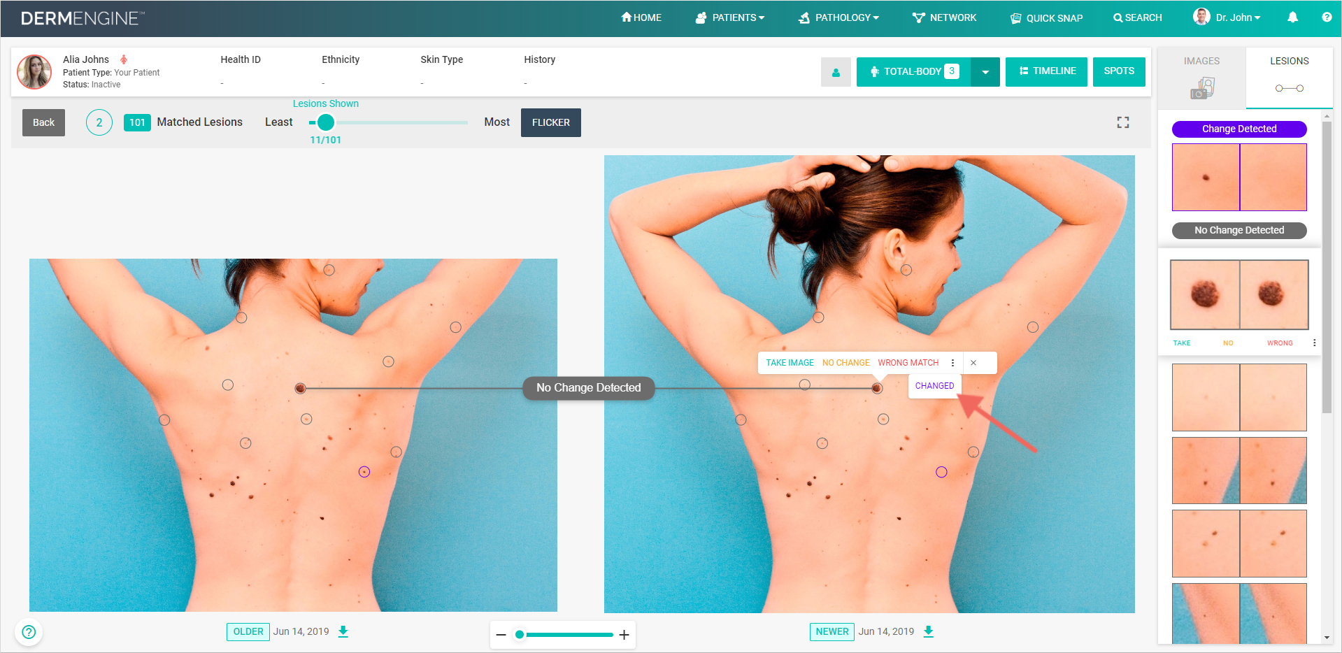 View lesions automatically sorted by amount of potential change for streamlined review workflows