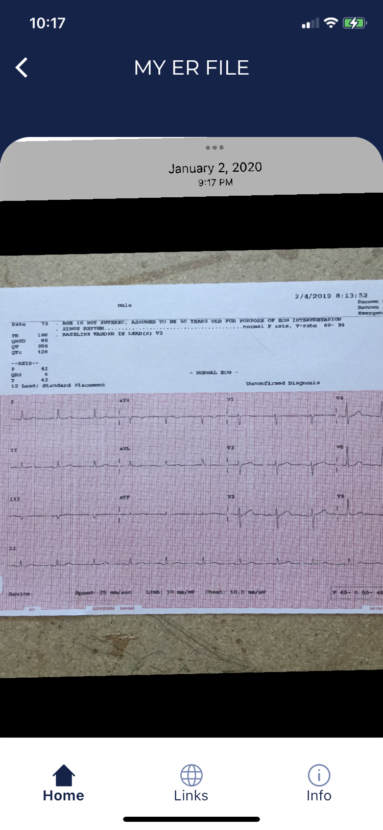 Picture of an EKG that can be enlarged to view details.