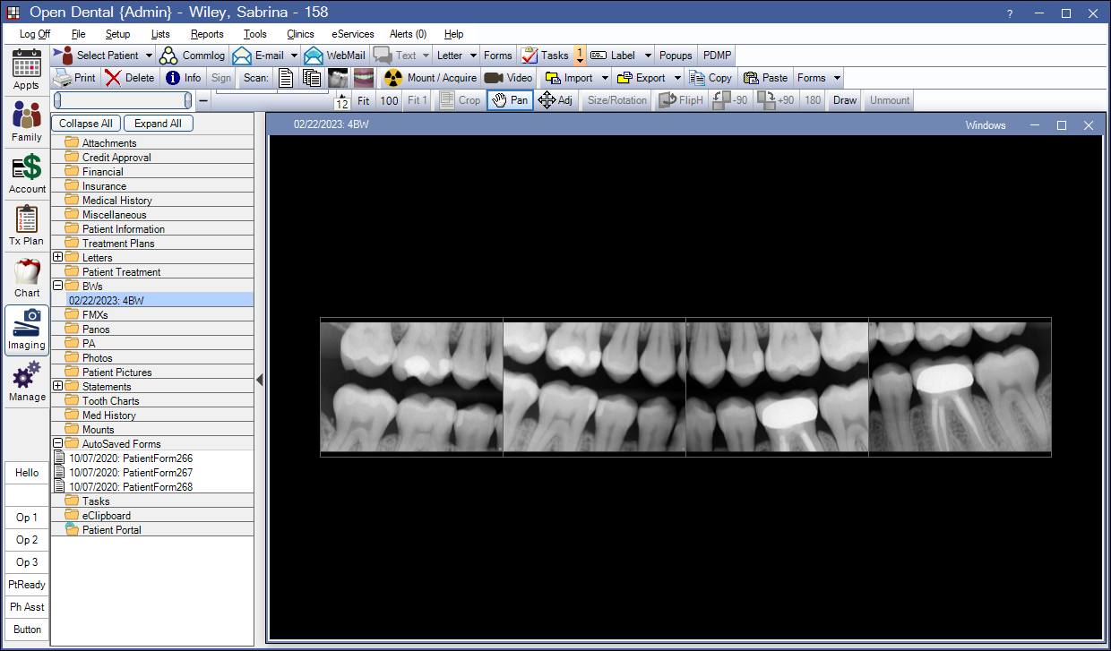Open Dental Software - Imaging Module. Used to manage patient pictures, documents, and take X-Rays.  Image displays example of bitewing X-Ray.