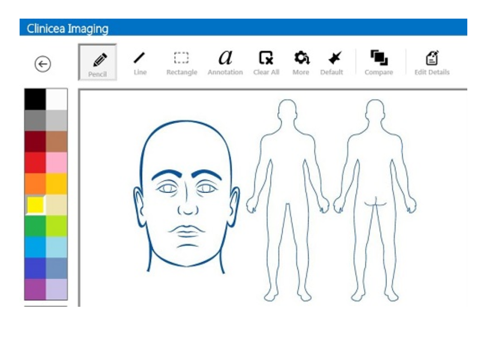 Imaging technology allows users to upload any type of image for a patient, and draw on or annotate them