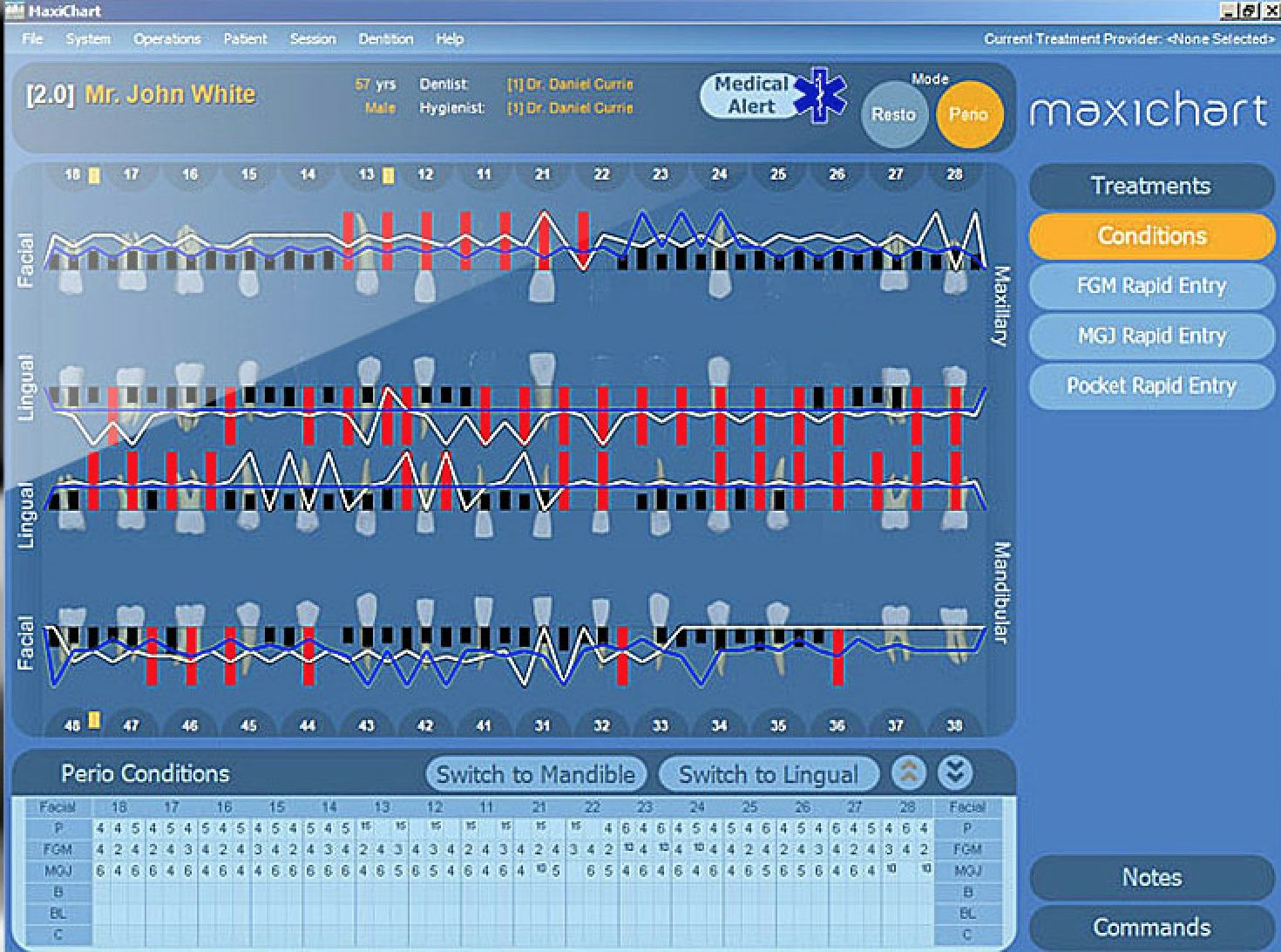 Maxident Software - Procedure codes