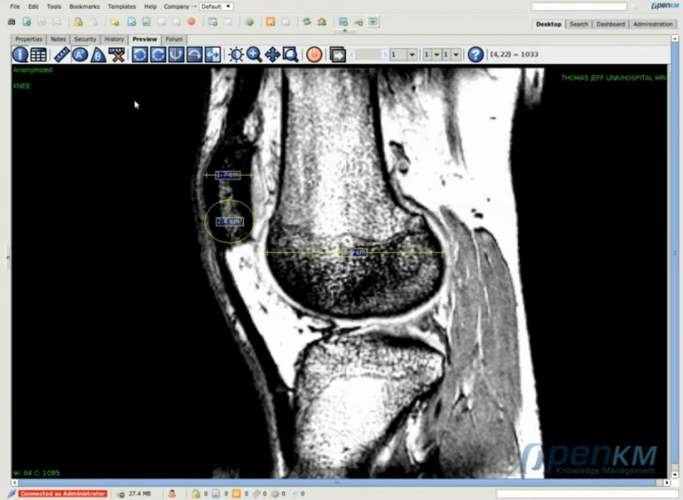 OpenKM Software - OpenKM DICOM viewer screenshot