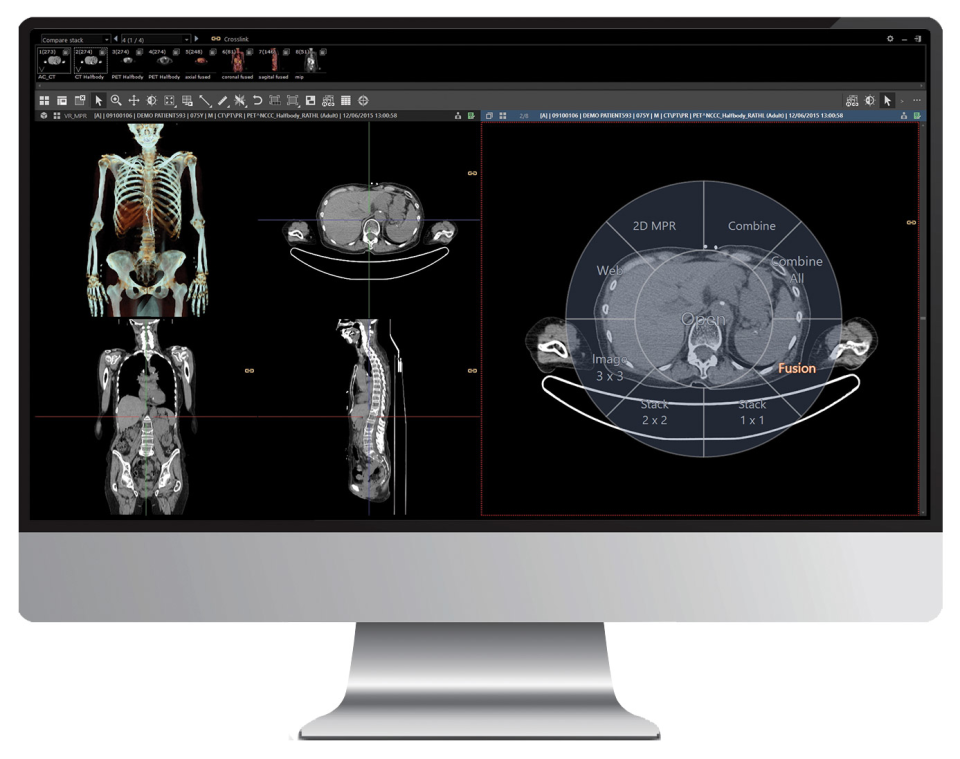 INFINITT PACS Software - 3