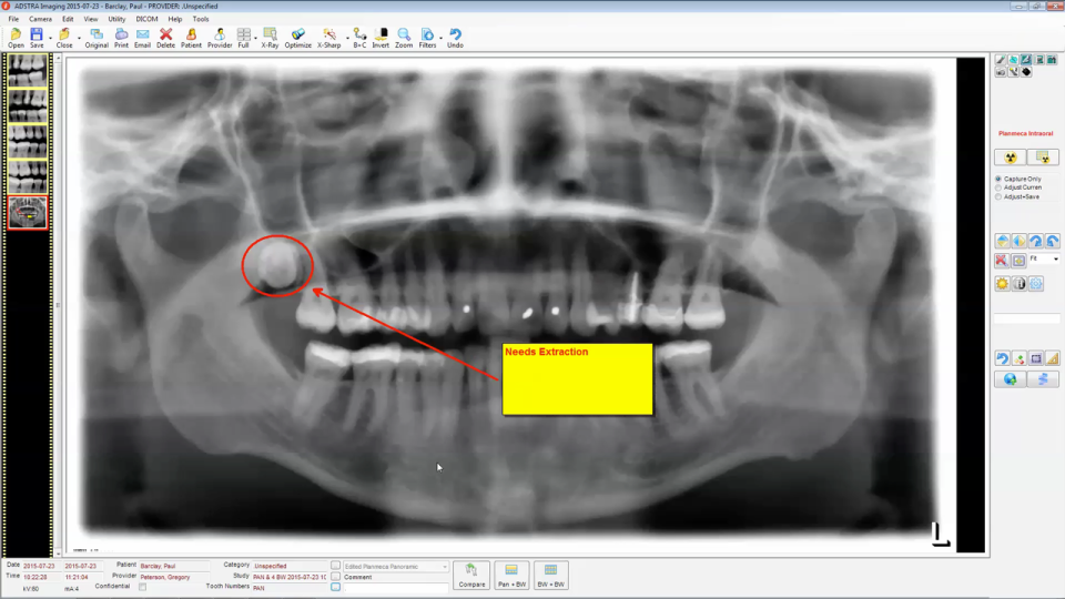 ADSTRA Dental Software Software - 1