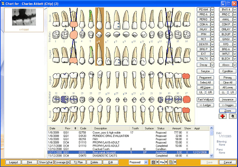Compare Dentrix Ascend Vs Eaglesoft 2023 Capterra