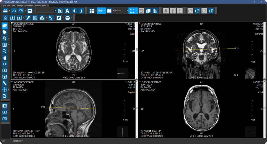 DICOM viewer view reports