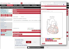 Cardiology-Cloud Software - Cardiology-Cloud HPI Drawing Tool - thumbnail