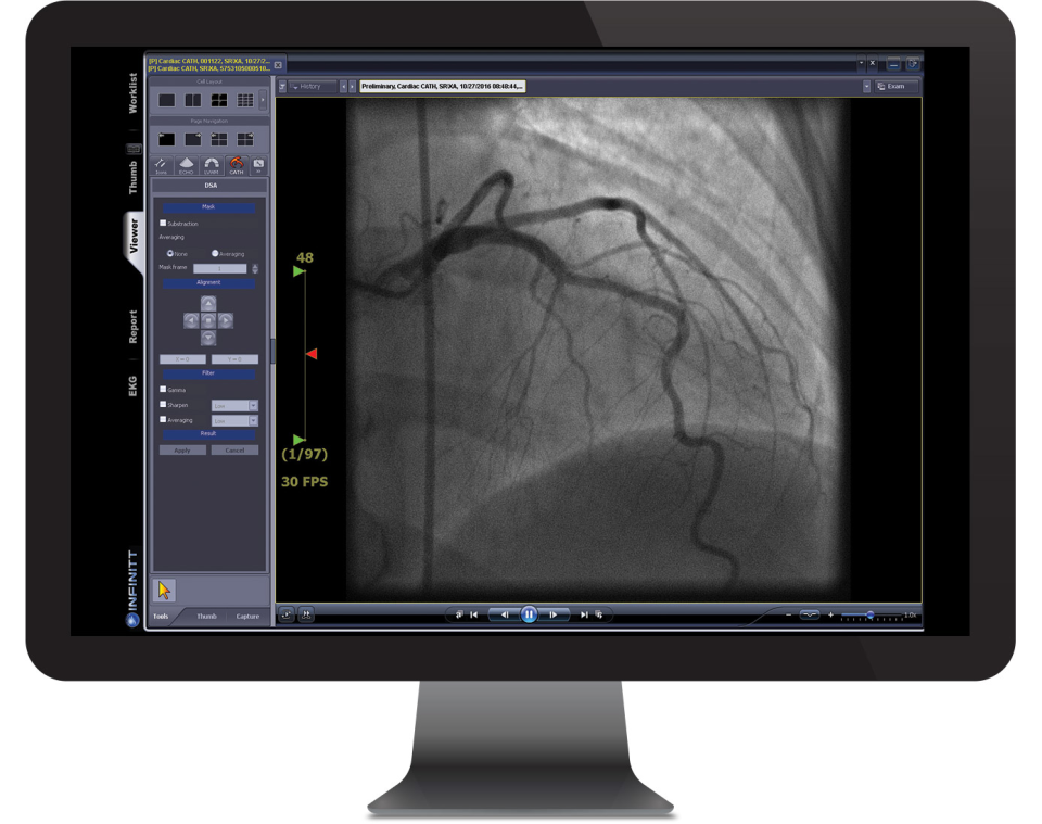 INFINITT Cardiology Suite Software - 1