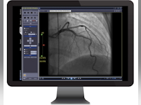 INFINITT Cardiology Suite Software - 1