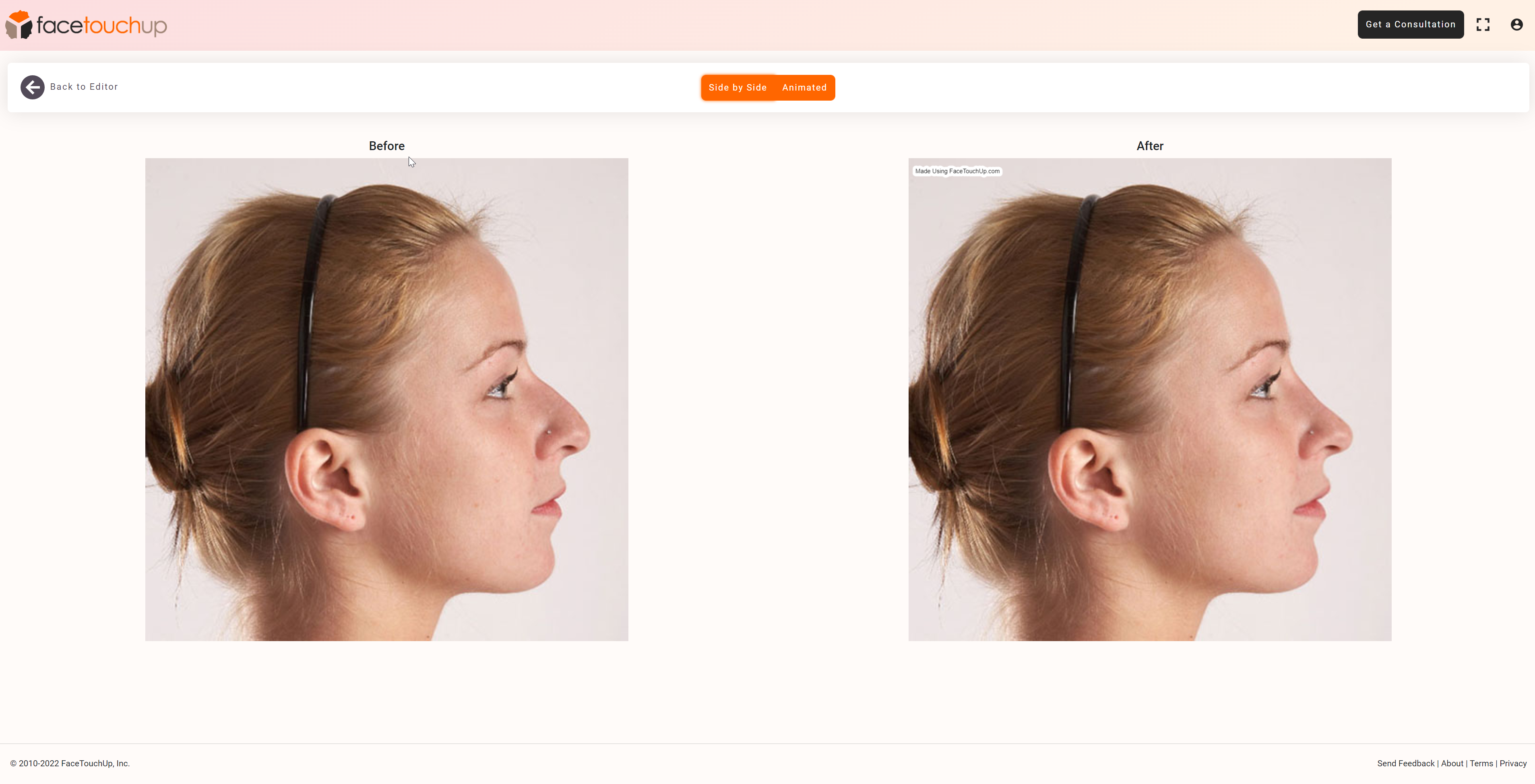 If you’re considering a nose job or rhinoplasty, then you may find it beneficial to upload your photo to a nose job simulation program such as FaceTouchUp. With this tool, you can reshape parts of your nose to experiment.