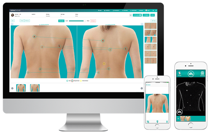 DermEngine screenshot: Image, map and detect changes to a patient's total body image in a matter of minutes with DermEngine's cross-platform capabilities.