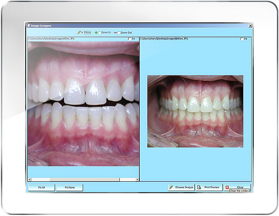 Maxident Software - Compare images and view previous treatment history graphically in the odontogram