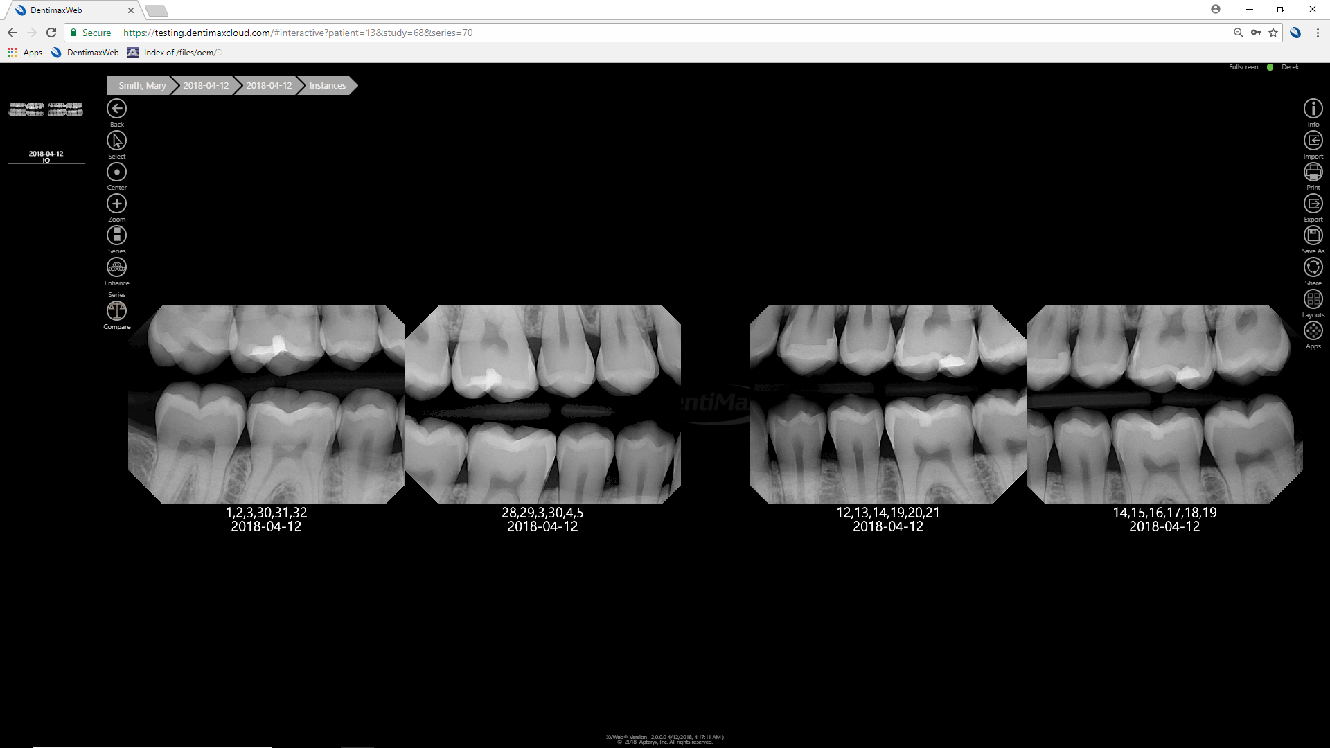 DentiMax Software - DentiMax Cloud Imaging