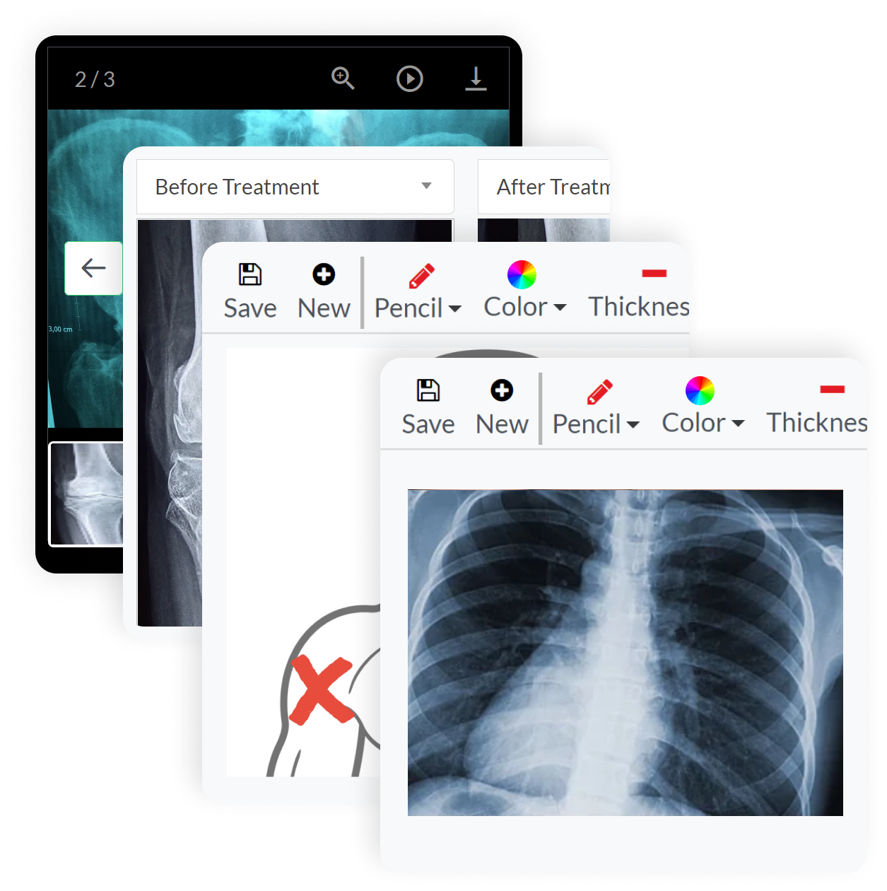 Clinicea Imaging lets you annotate, take pictures, and more, on the cloud.