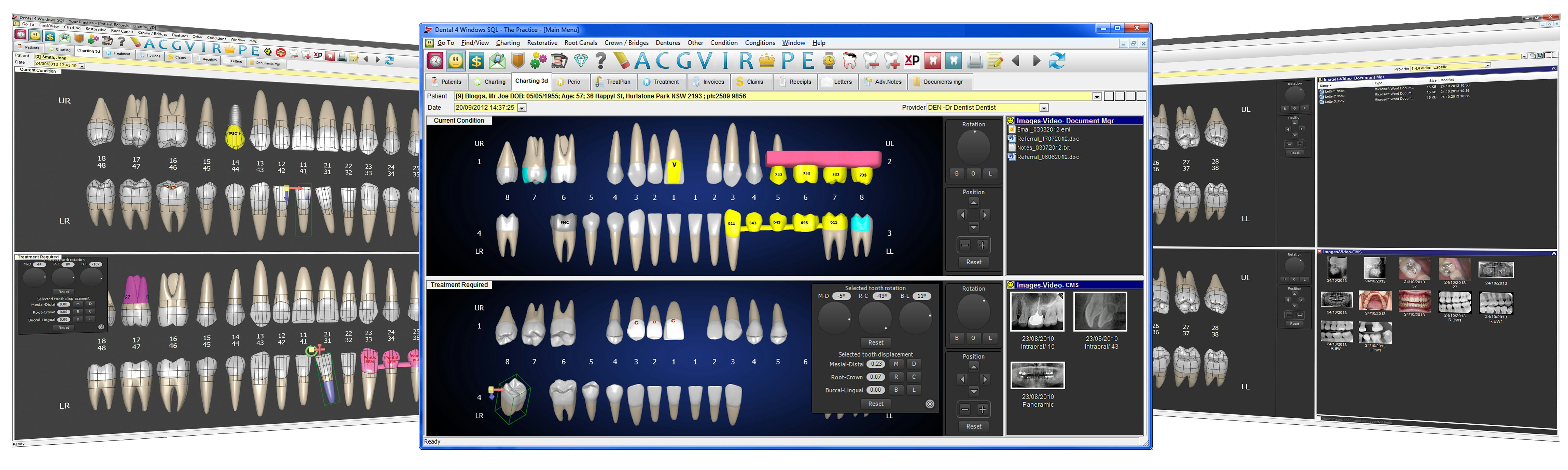 Dental4Windows Software - 2