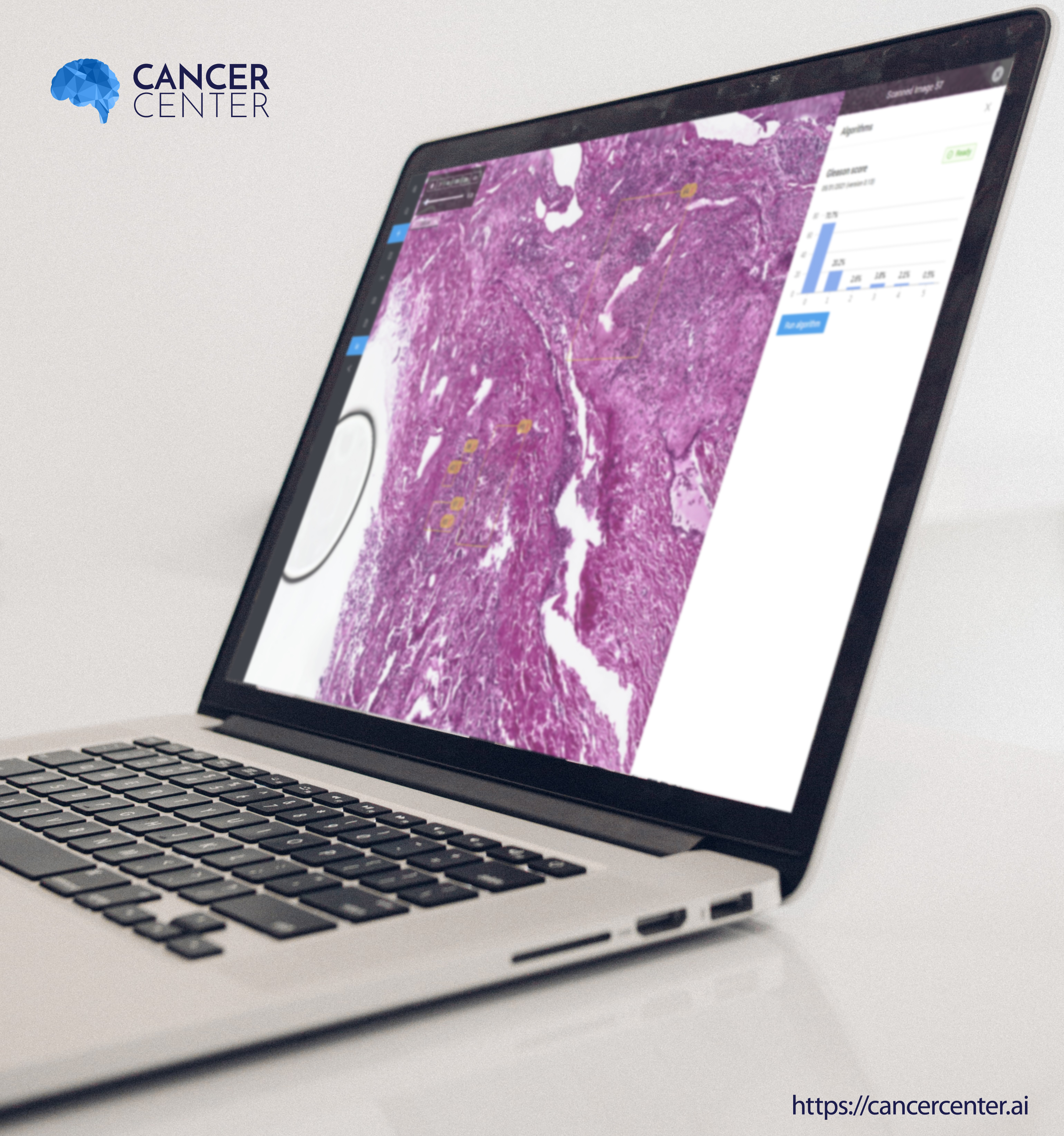 PathoPlatform screenshot: PathoPlatform - Digital Pathology AI Web Platform