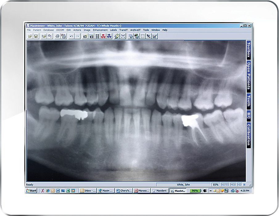 Capture images from different brands of digital imaging equipment