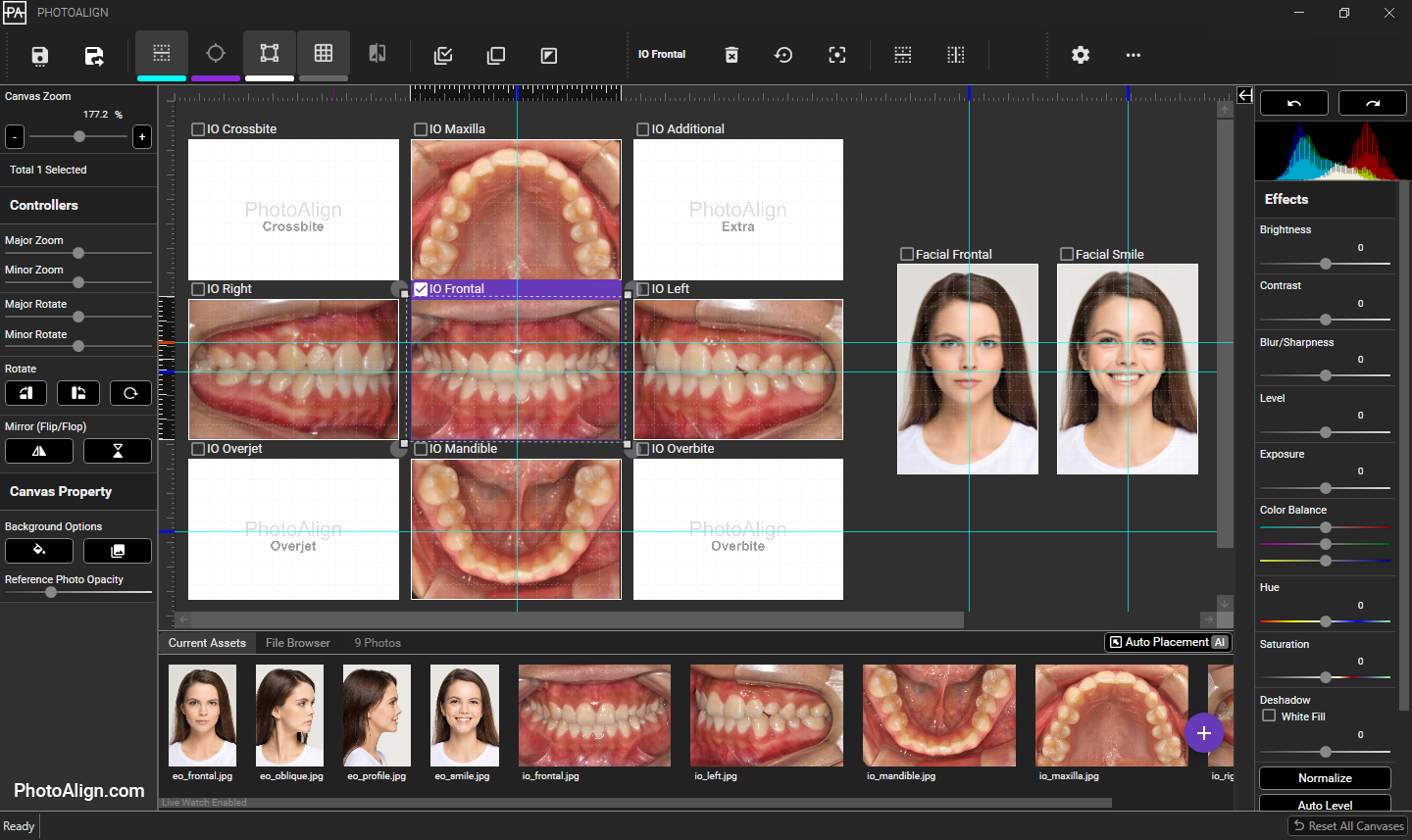 PhotoAlign screenshot: PhotoAlign main editor