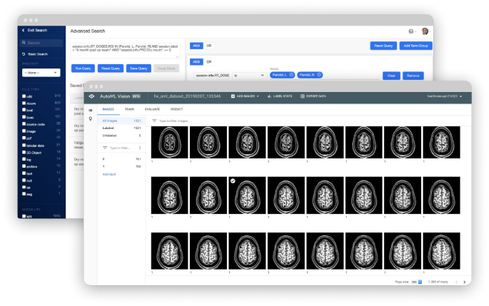 Flywheel Enterprise streamlines imaging research with a medical imaging platform that automates time-consuming processes and scales for your needs. Our secure data management and AI platform gives you the power to do research in high gear.