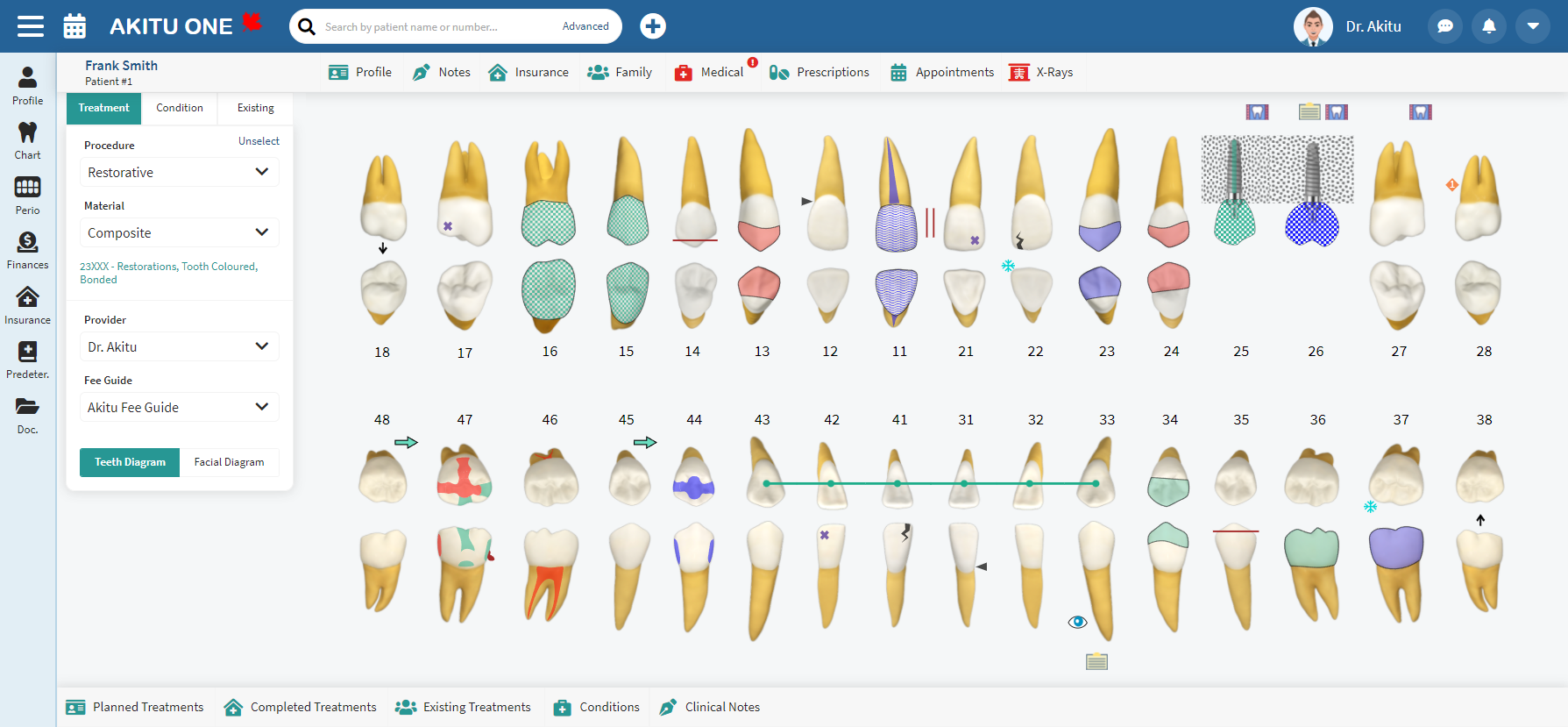 Akitu One Software - Teeth Charting with Akitu One is more easy and comprehensive.