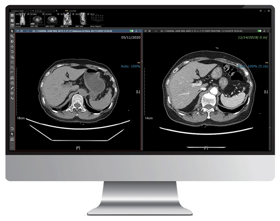 INFINITT PACS Software - 2