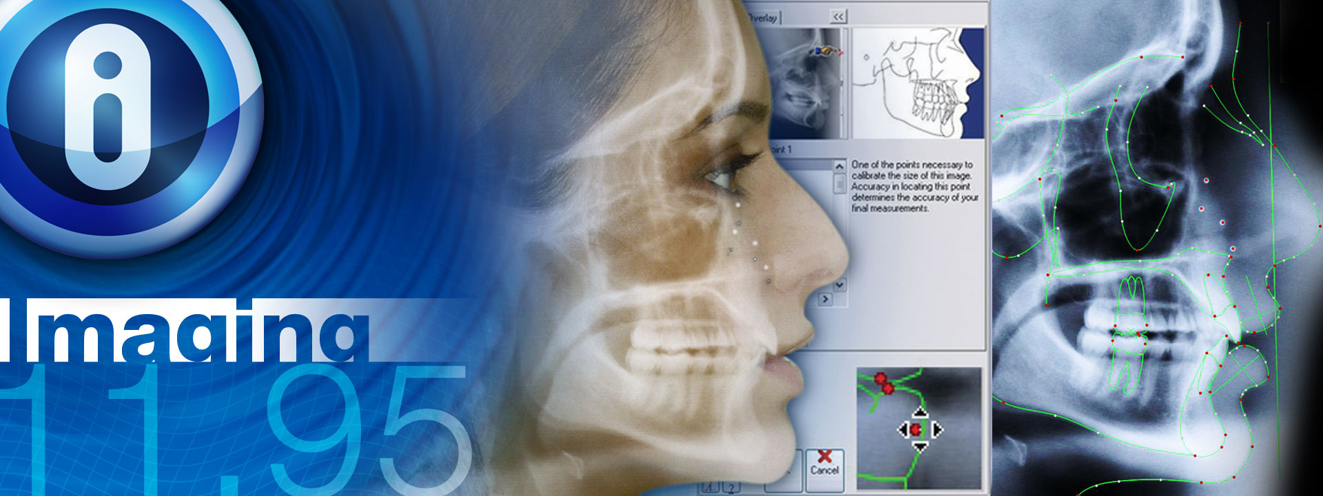 Dolphin Ceph Tracing allows you to analyze cephalometric radiographs and create progress superimpositions quickly and accurately. Utilized by thousands of practices and researchers throughout the world.