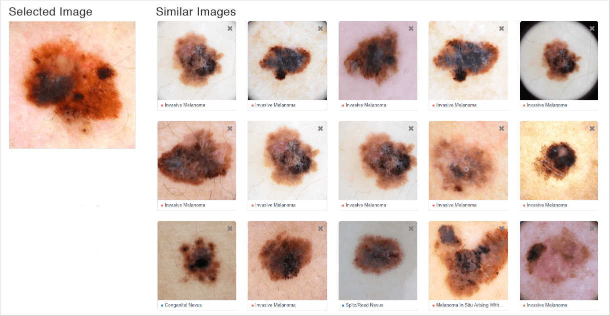 Review visually similar images to your current case to gain deeper clinical insights.