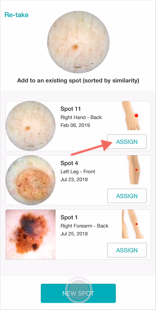 Assign follow up dermoscopy images in a matter of seconds with the support of DermEngine's Smart Recommendation tool