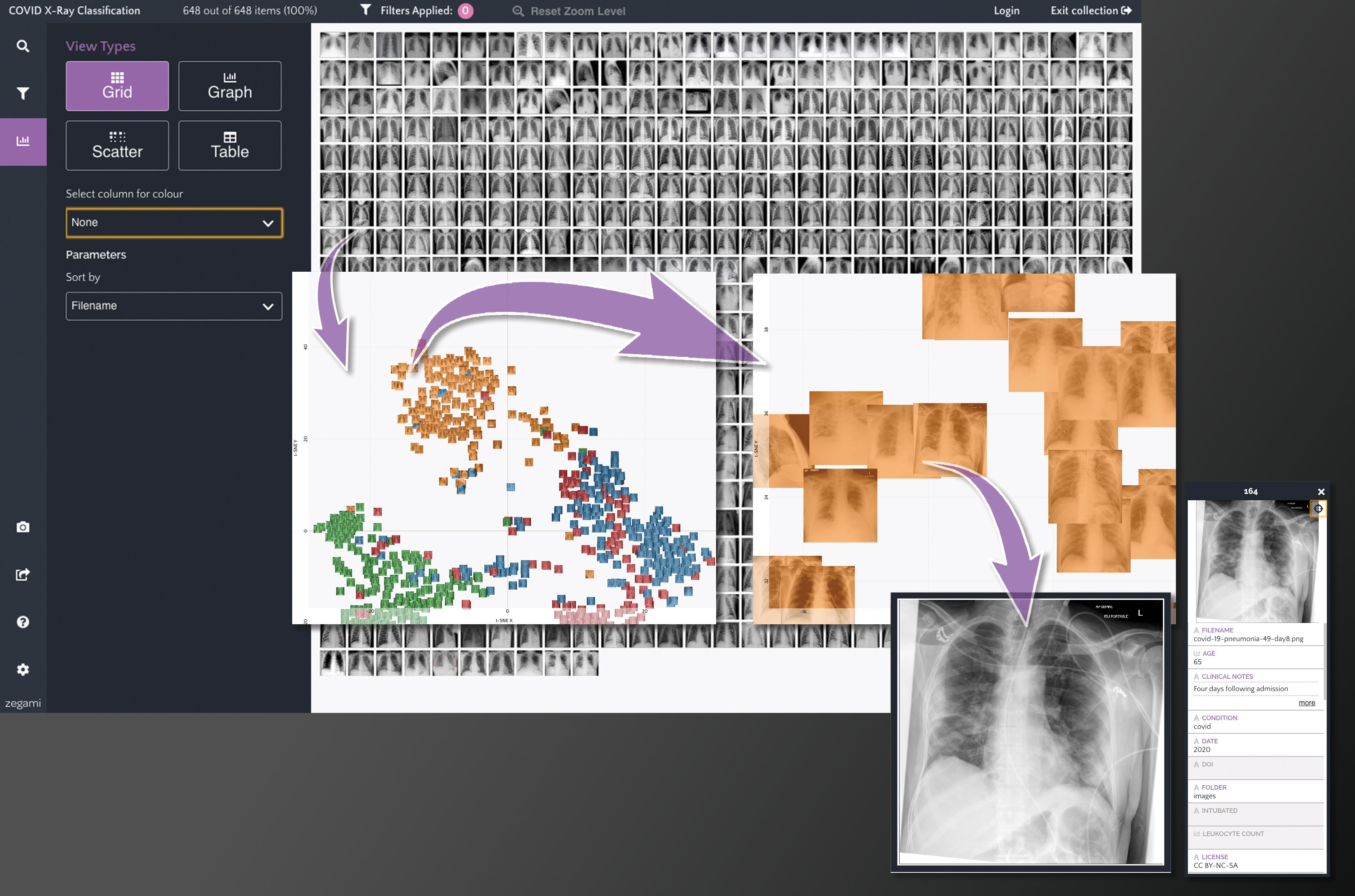Zegami COVID-19 chest X-Ray analysis