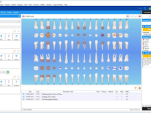 ABELDent Software - ABELDent clinical charting