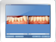 Maxident Software - Show patients their dental images chair side with MaxiViewer