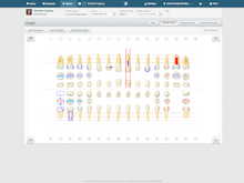 Dentrix Ascend Software - The clinical charts in Dentrix Ascend are customizable, with options for users to add procedures, conditions, and notes