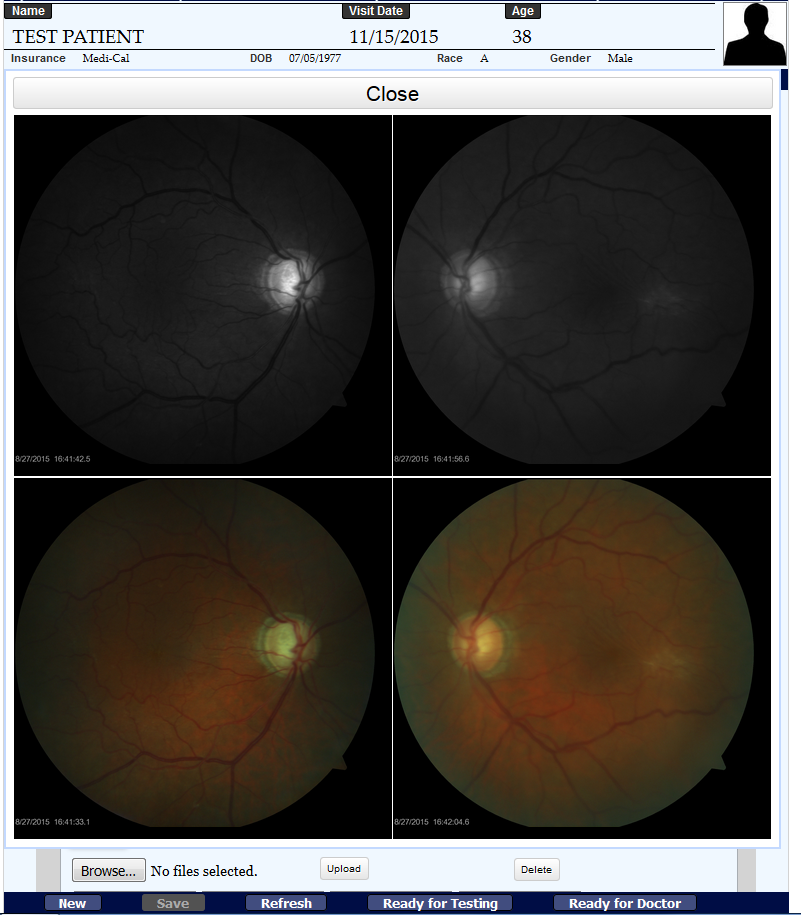 Image comparison