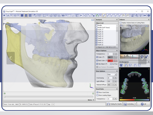 Onyx Ceph Price, Features, Reviews & Ratings - Capterra India