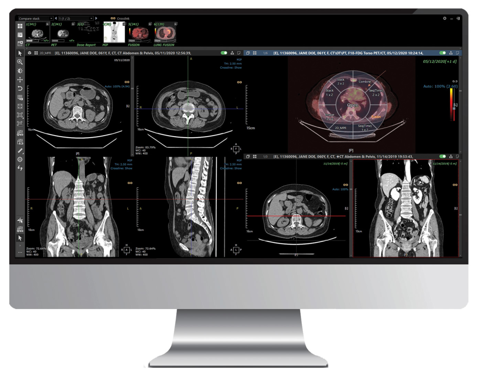 INFINITT PACS Software - 1