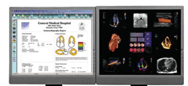 Cardiovascular Information System Reports