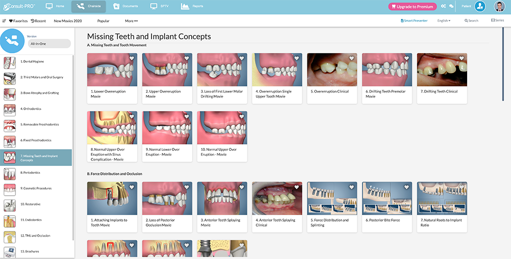 Consult-PRO dental charts