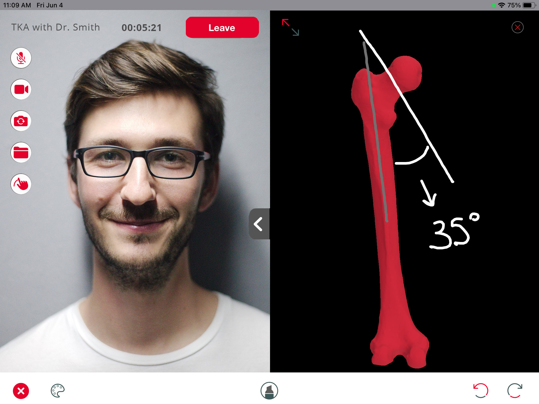 Enhatch screenshot: Our HIPPA-Compliant Videoconferencing and Collaboration software allows Reps to remote into the OR and work with the surgeon in realtime during a surgery.